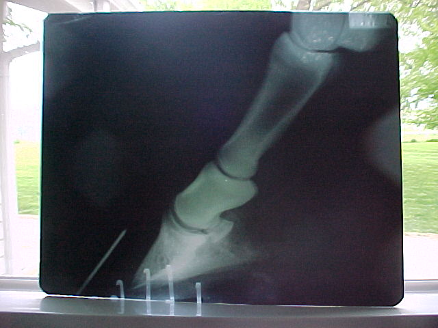 levi's x-ray