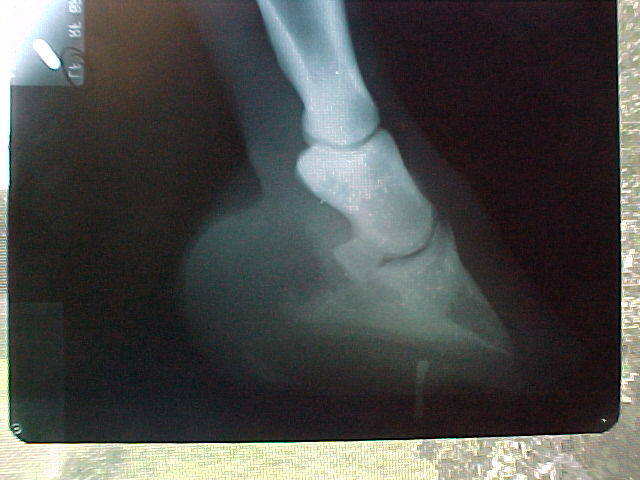 left foot
