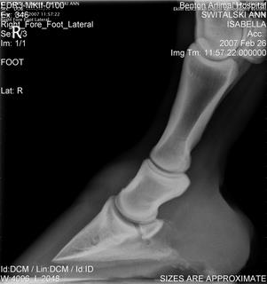 Right foot