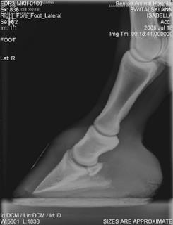 Right foot 08