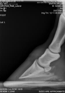 Left foot 07