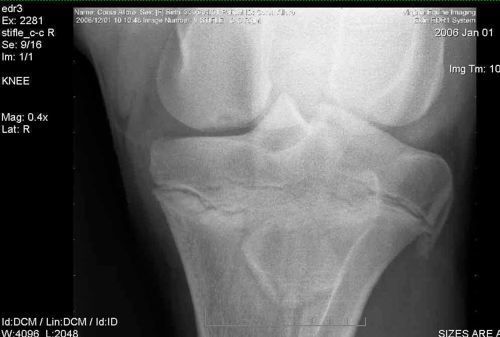 Right stifle-1