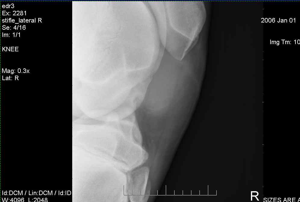 Right Stifle-3