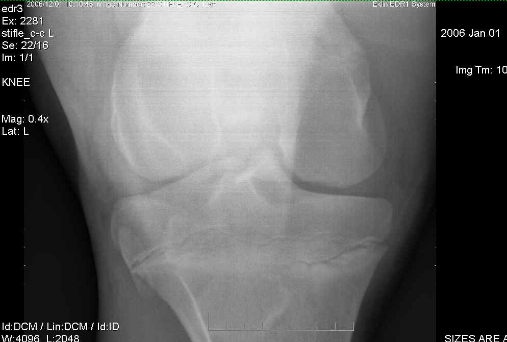 Left Stifle-1