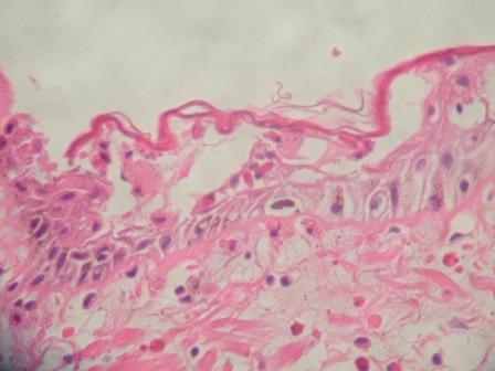 histo 2