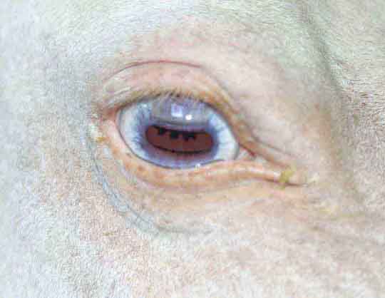 right eye