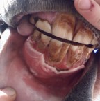 gums again