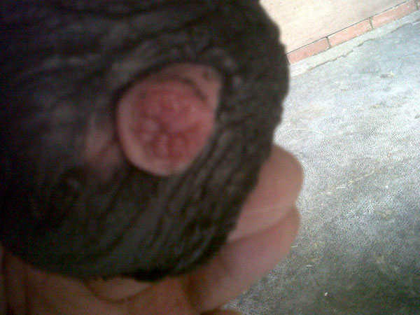 little bubbles on penis