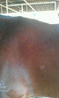 Normal Left Shoulder