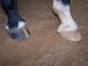 foot1