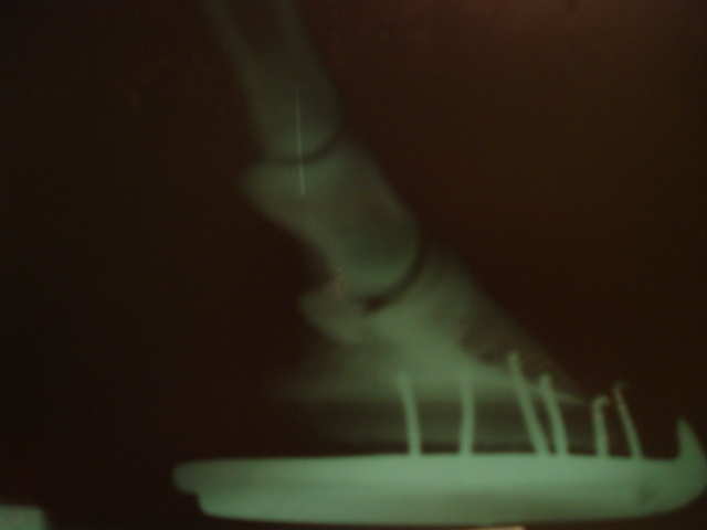 right fore xray