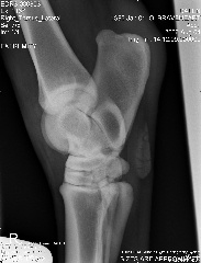 right tarsus lateral